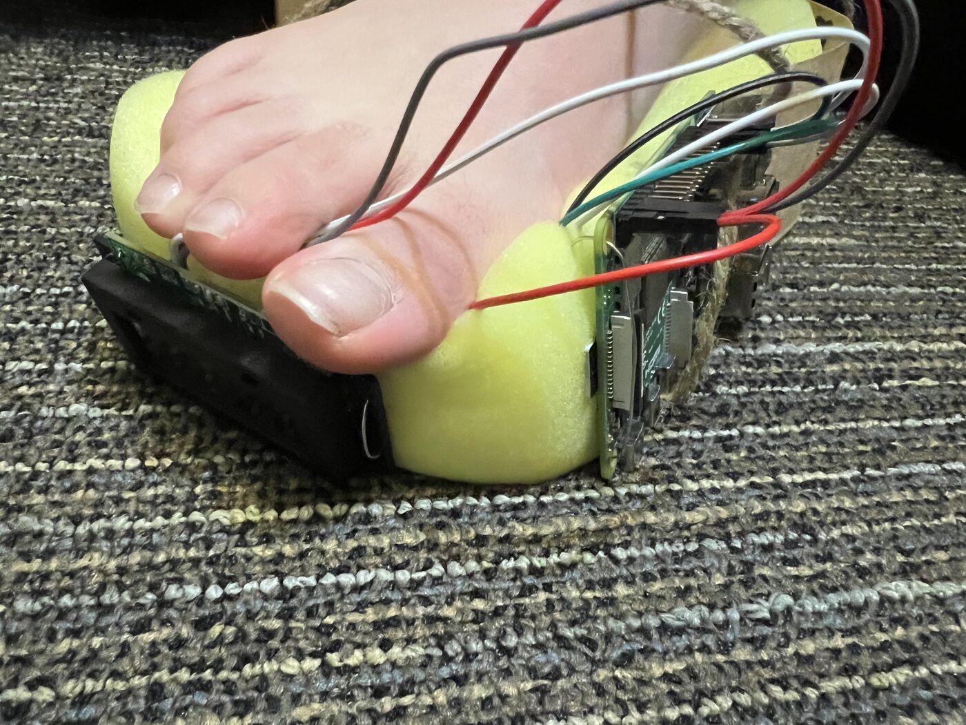 second view of the assembled prosthetic